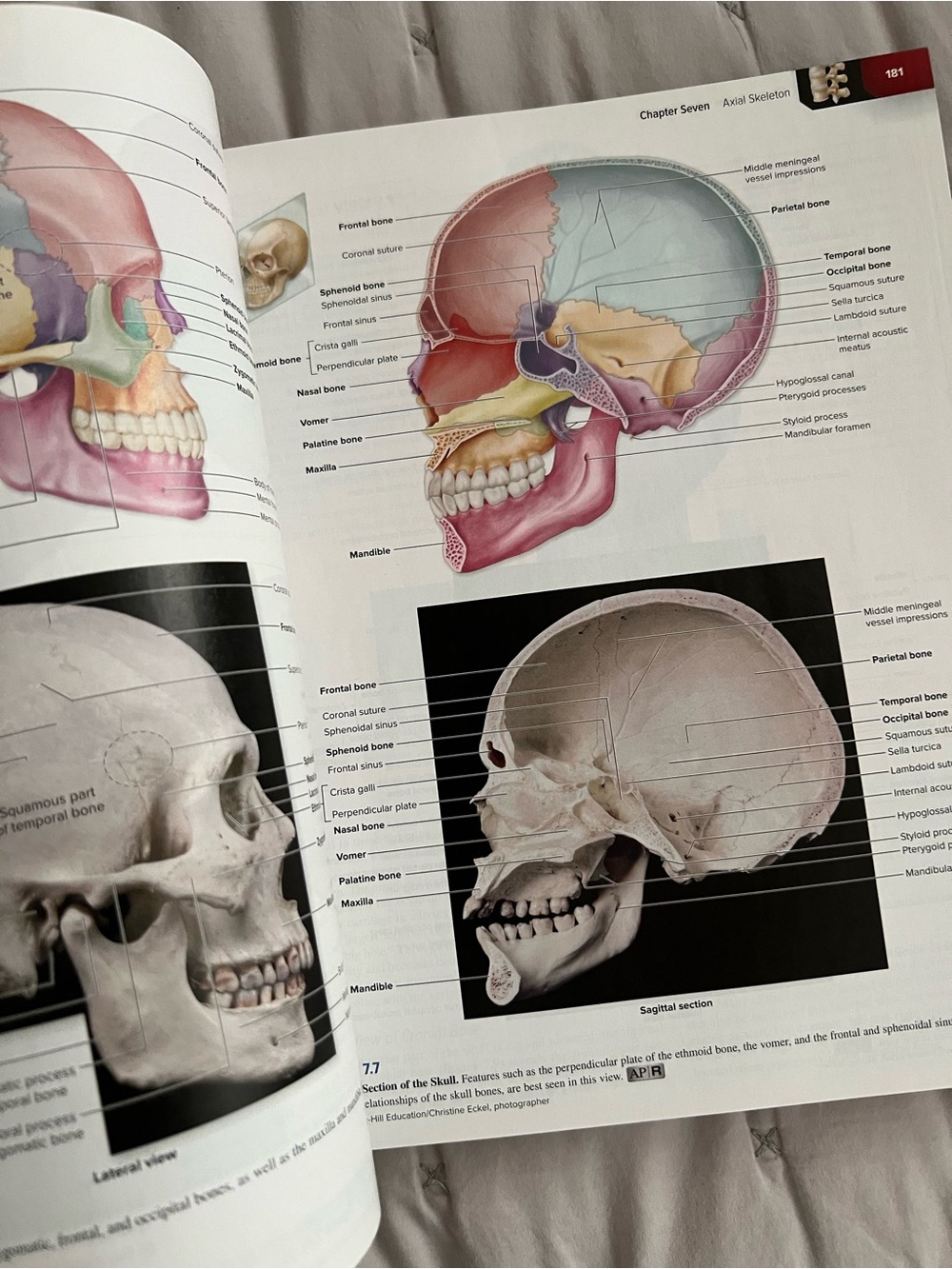 Human Anatomy Textbook 5th Edition - Picture 5 of 6